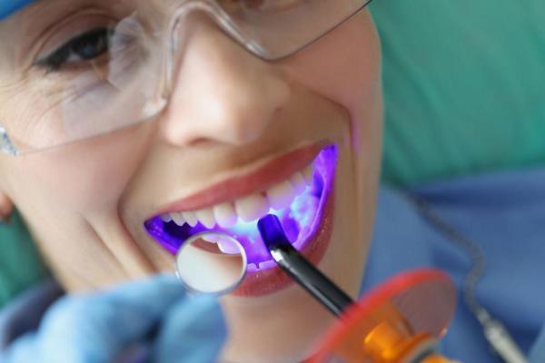 کشف زودهنگام پوسیدگی دندان با فناوری نو دندانپزشکی